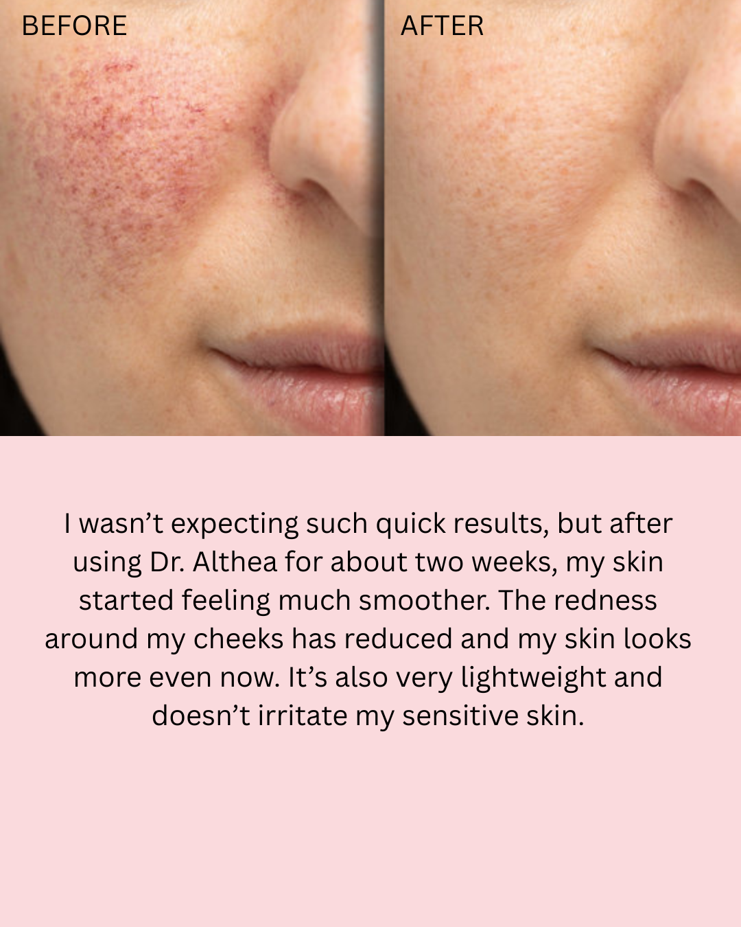 Dr Althea 345 Relief cream