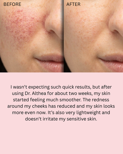 Dr Althea 345 Relief cream