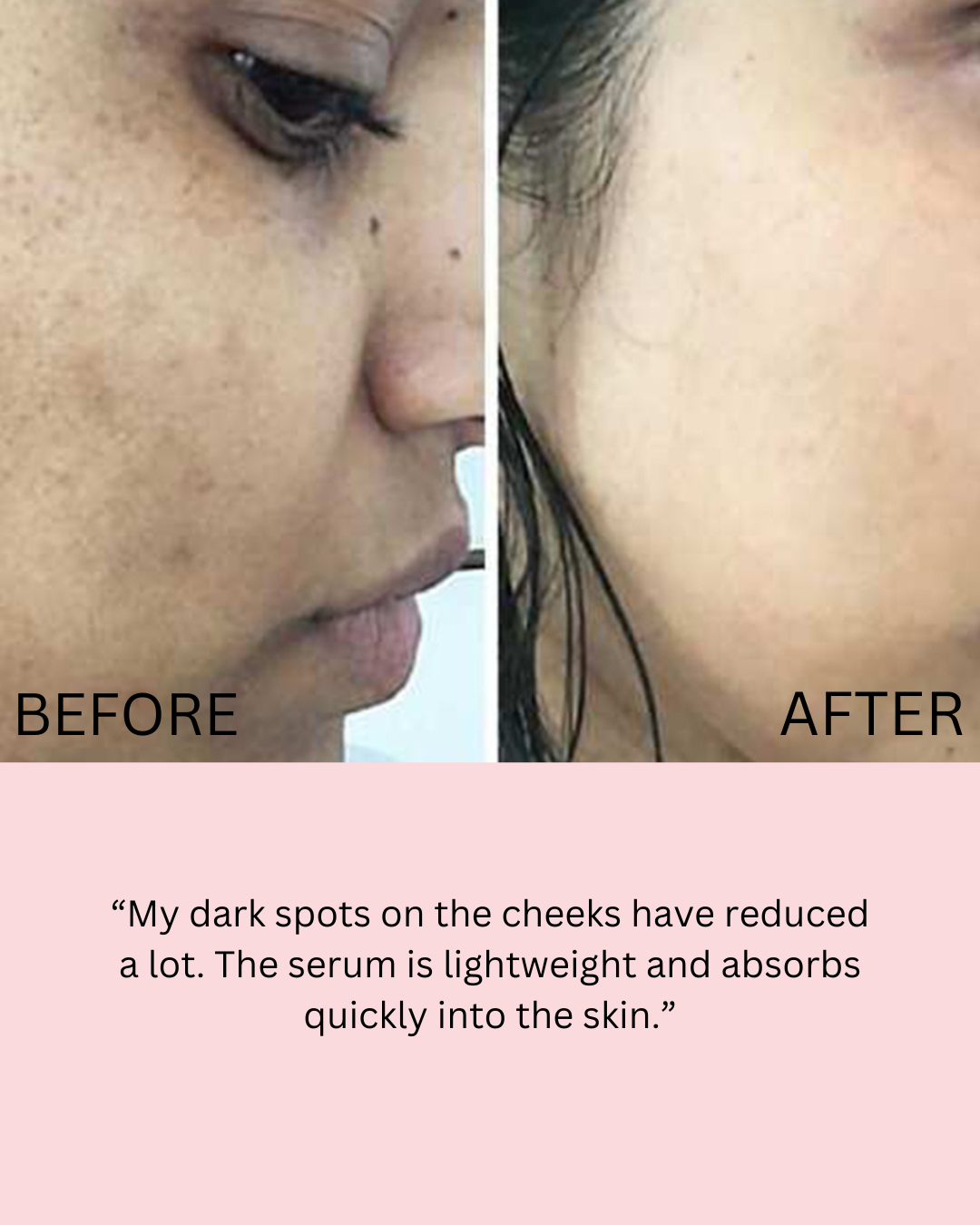Retinol Shot Tighting Serum