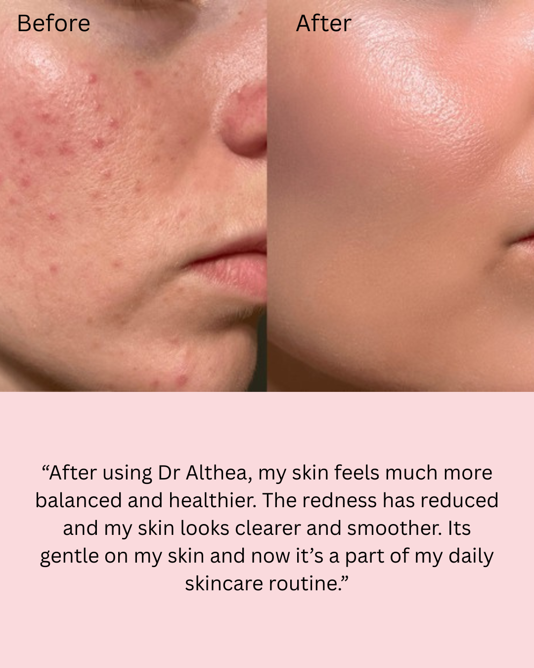 Dr Althea 345 Relief cream