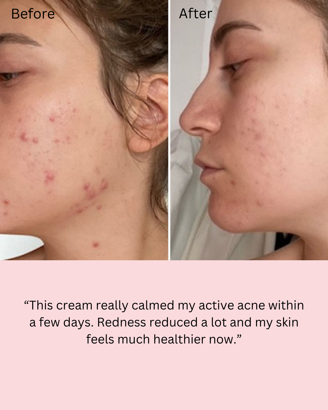 Dr Althea 345 Relief cream