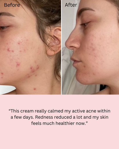 Dr Althea 345 Relief cream