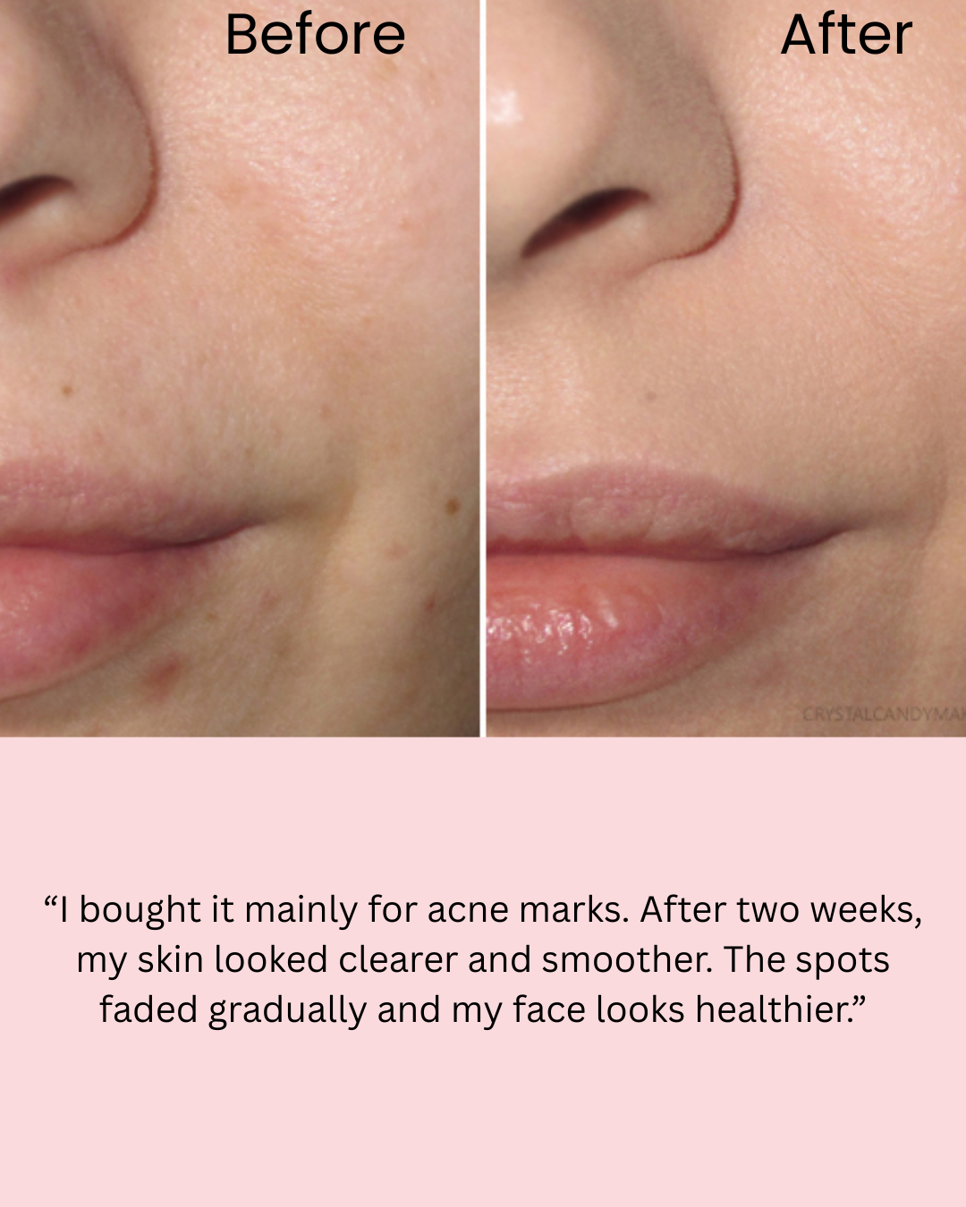 Medicube Salmon DNA PDRN Pink Collagen Jelly Mask