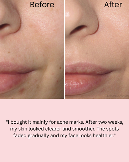 Medicube Salmon DNA PDRN Pink Collagen Jelly Mask