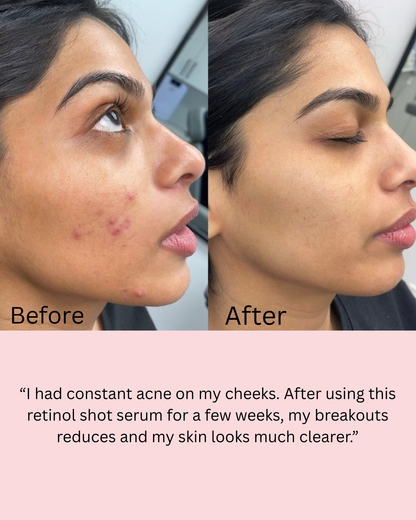 Retinol Shot Tighting Serum