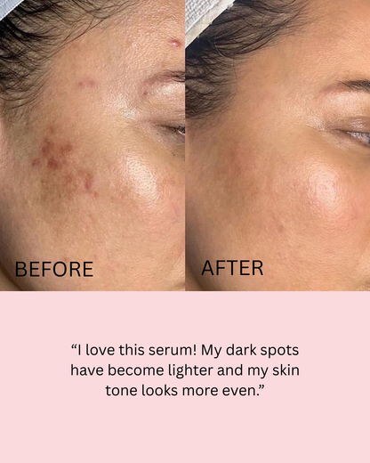 Retinol Shot Tighting Serum